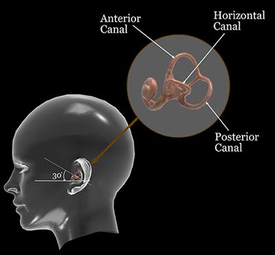 BPPV Simulation: A Powerful Tool to Understand and Optimize the Diagnostics and Treatment of all Possible Variants of BPPV